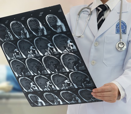Neurology Neurology