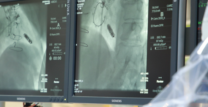 A new qualitative implantation of a wireless, nano-sized heart pacemaker device